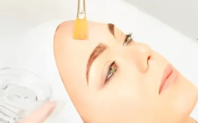 Renueva tu piel con el mejor peeling químico de Málaga